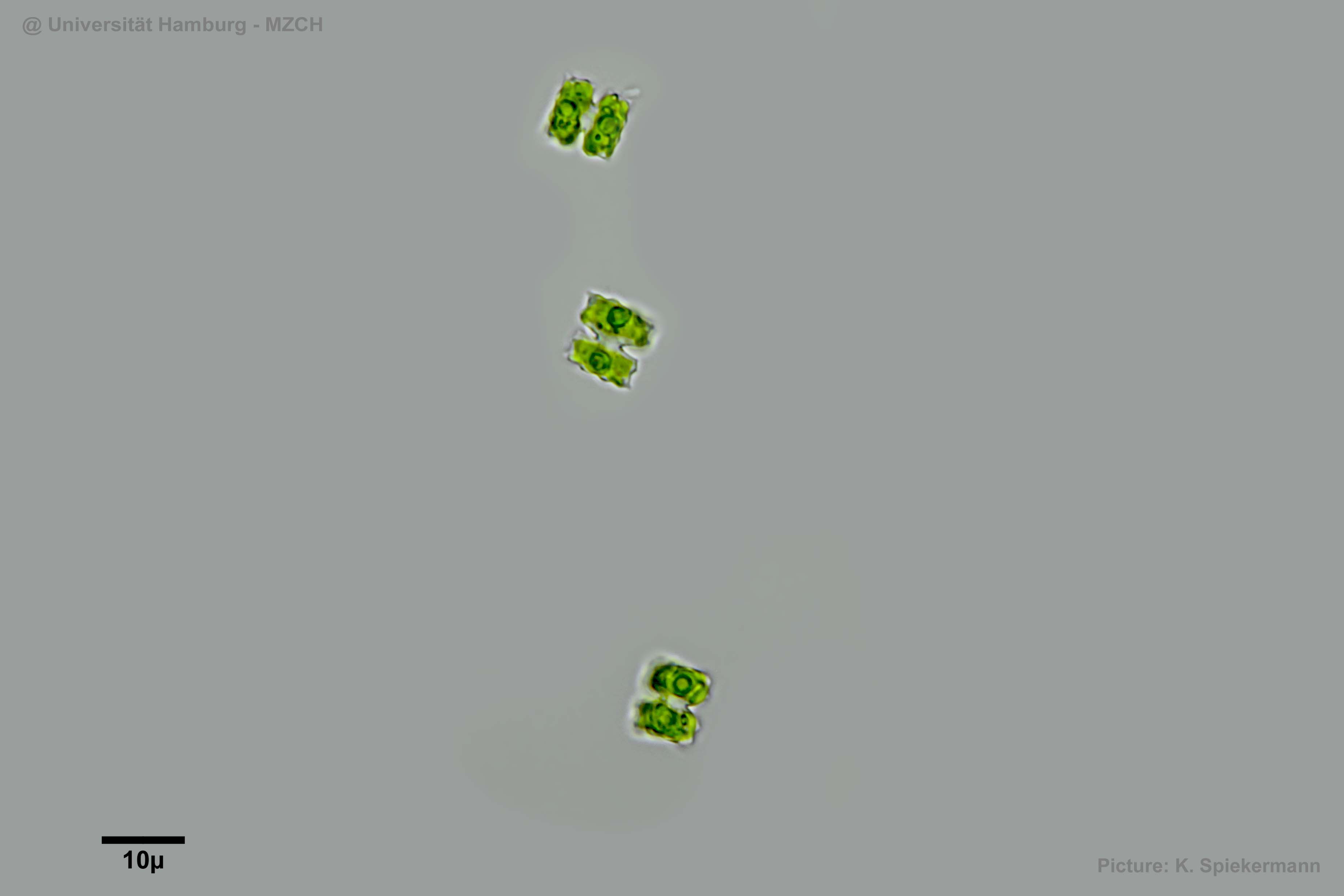 463_Cosmarium dilatatum_WHM